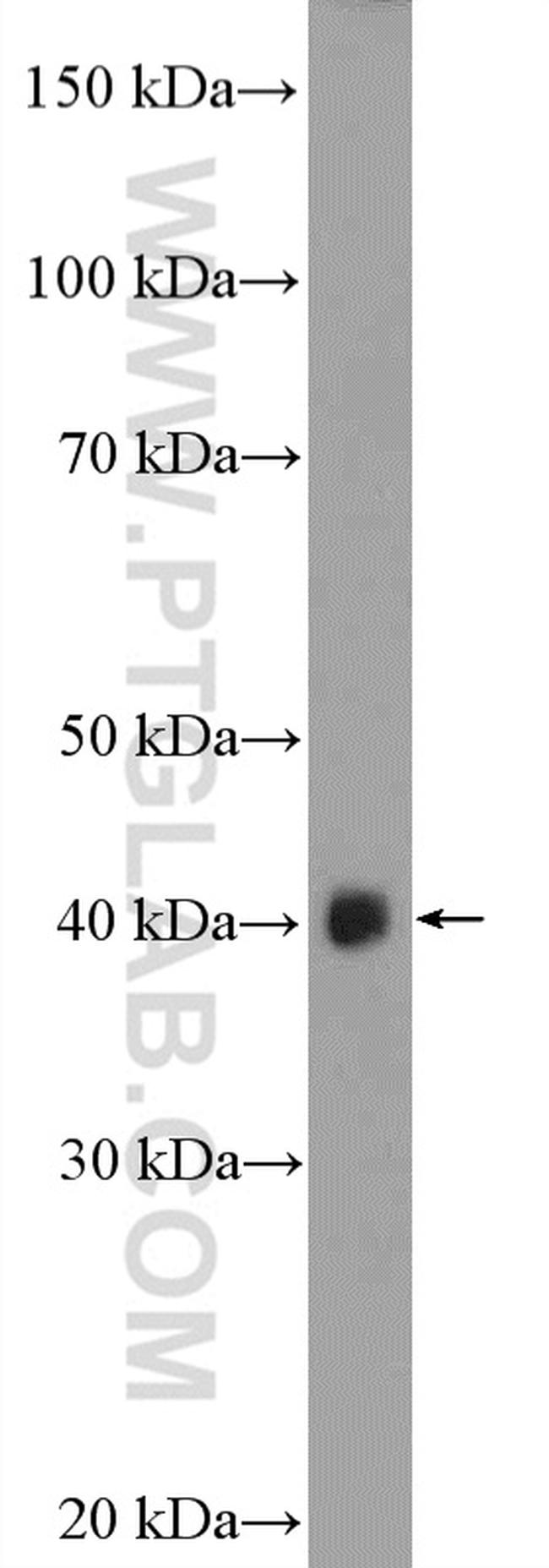 ASB5 Antibody in Western Blot (WB)