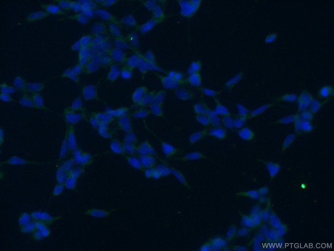 ANKRD50 Antibody in Immunocytochemistry (ICC/IF)