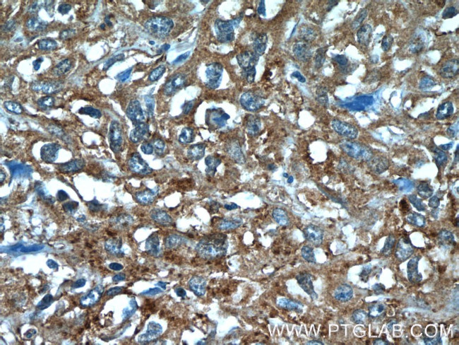 ANKRD57 Antibody in Immunohistochemistry (Paraffin) (IHC (P))
