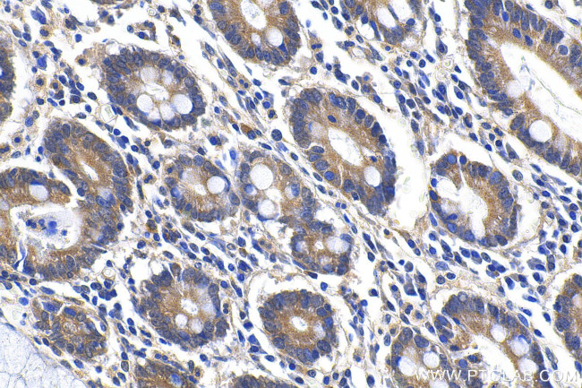 ANKRD22 Antibody in Immunohistochemistry (Paraffin) (IHC (P))