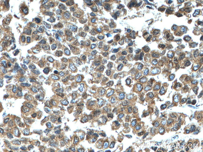 KRT23 Antibody in Immunohistochemistry (Paraffin) (IHC (P))