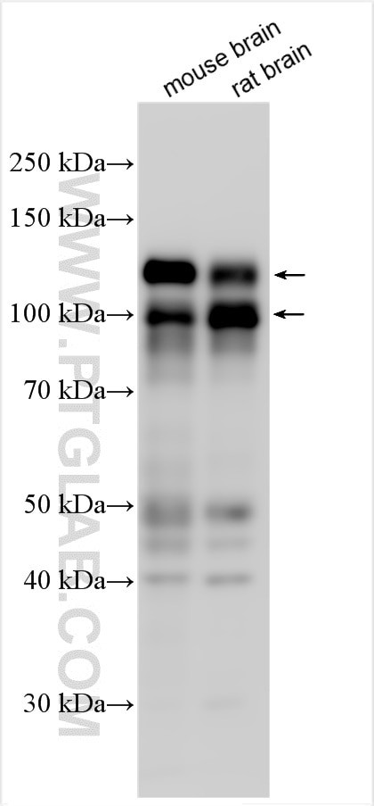 CNKSR2 Antibody in Western Blot (WB)