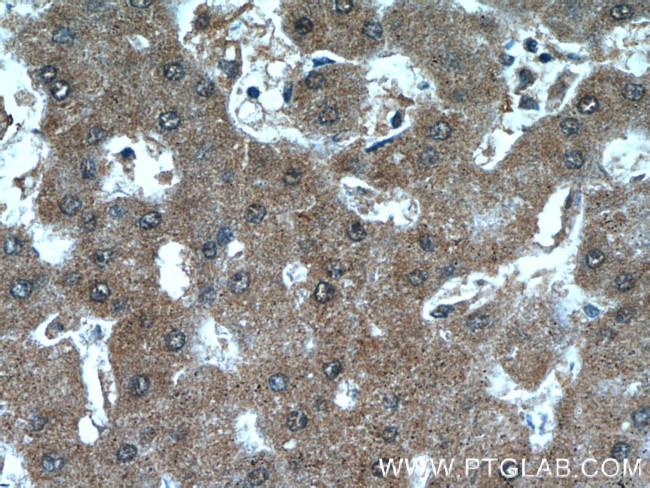 ANKS3 Antibody in Immunohistochemistry (Paraffin) (IHC (P))