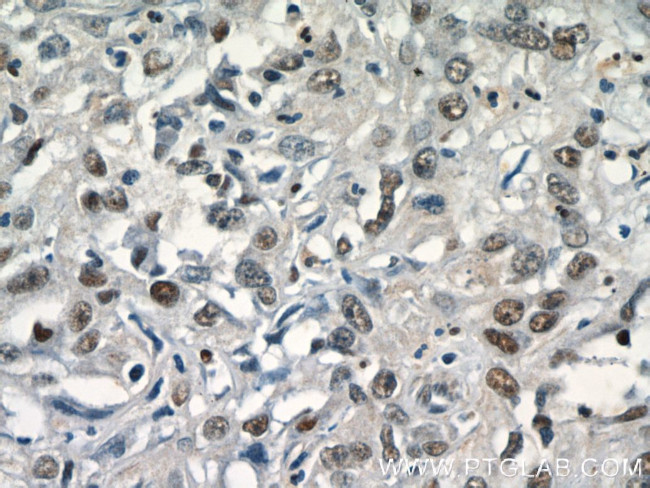 SGF29 Antibody in Immunohistochemistry (Paraffin) (IHC (P))