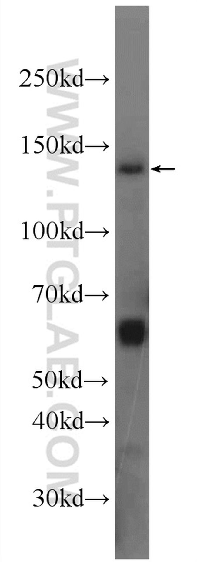Matrilin 2 Antibody in Western Blot (WB)