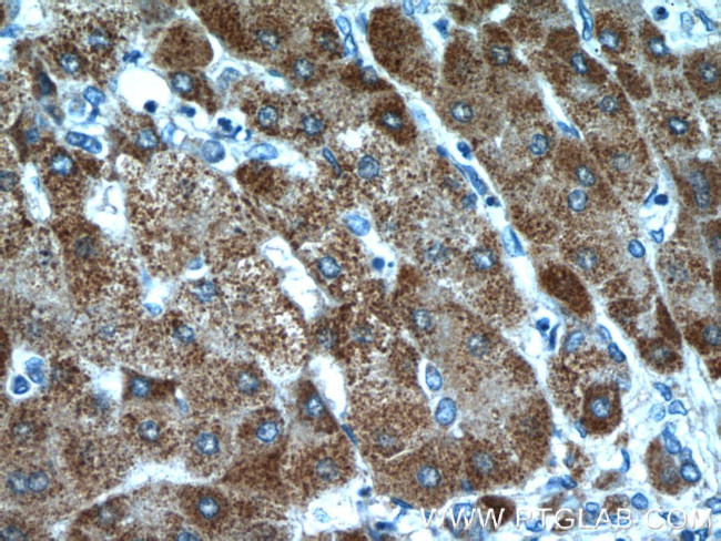 ITIH4 Antibody in Immunohistochemistry (Paraffin) (IHC (P))