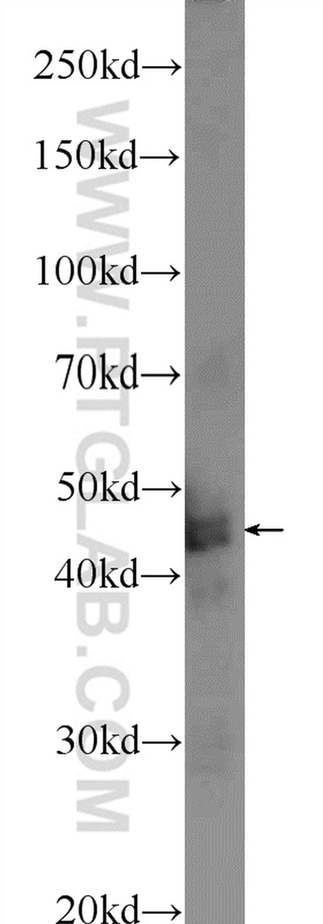 TMEM201 Antibody in Western Blot (WB)