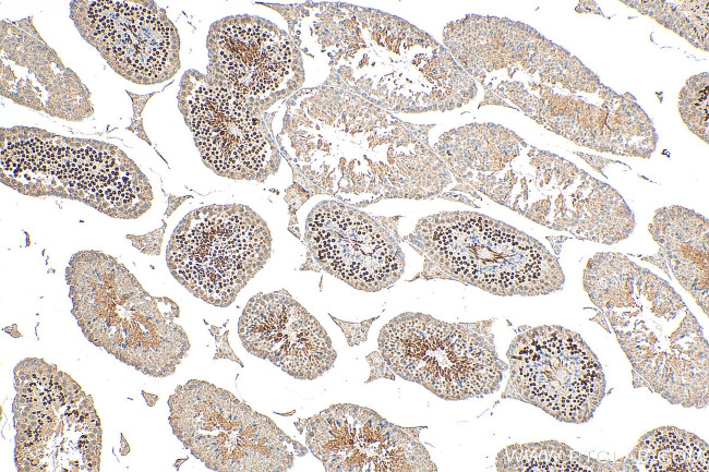PCGF6 Antibody in Immunohistochemistry (Paraffin) (IHC (P))