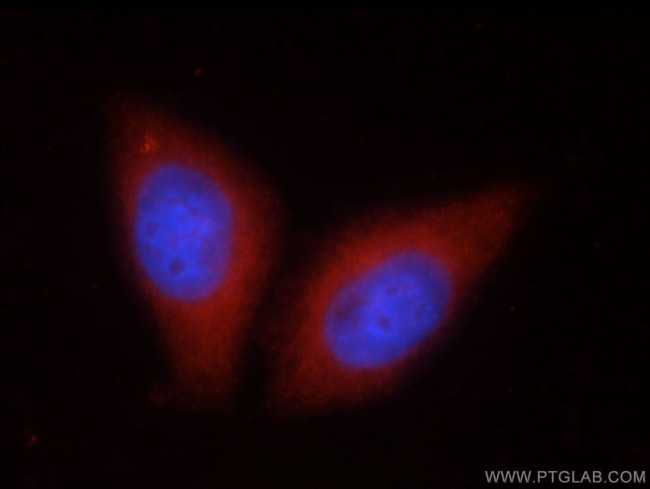 SIL1 Antibody in Immunocytochemistry (ICC/IF)
