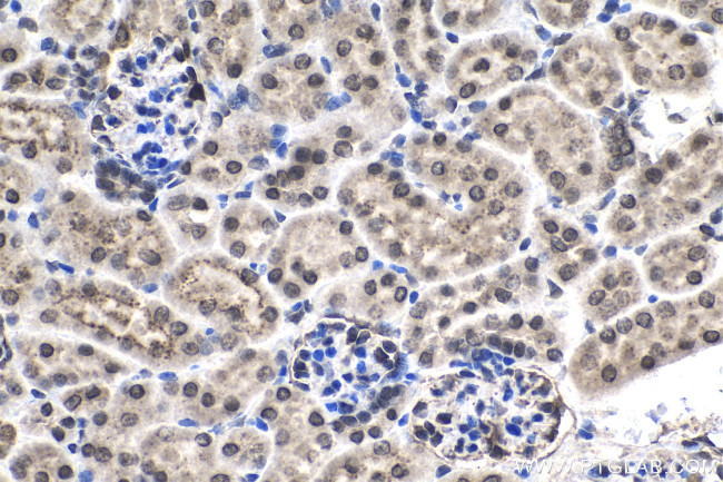 NUP214 Antibody in Immunohistochemistry (Paraffin) (IHC (P))