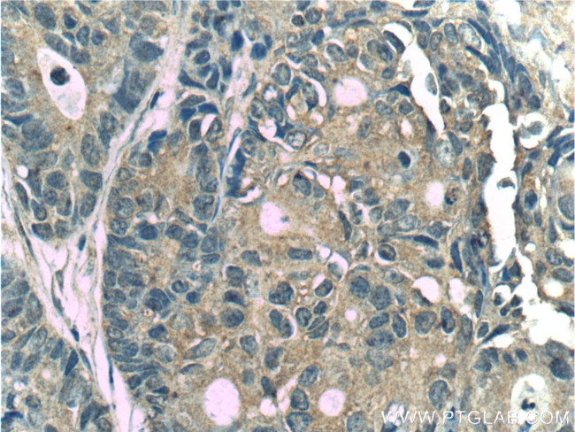 CYS1 Antibody in Immunohistochemistry (Paraffin) (IHC (P))