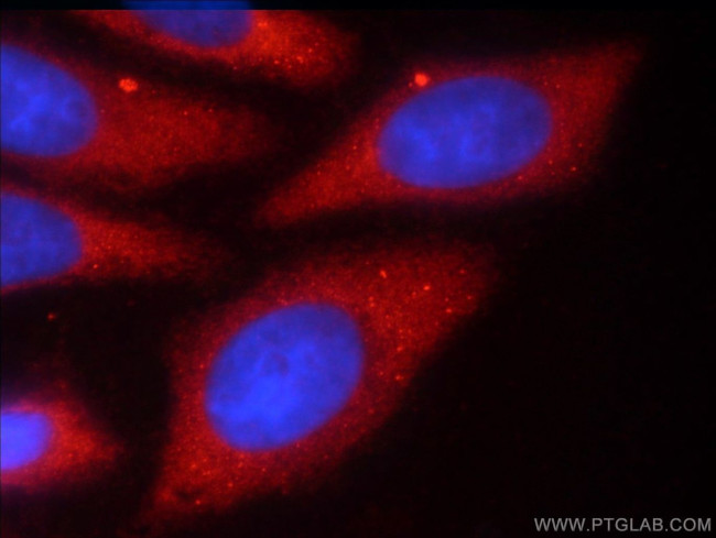 TMEM59 Antibody in Immunocytochemistry (ICC/IF)