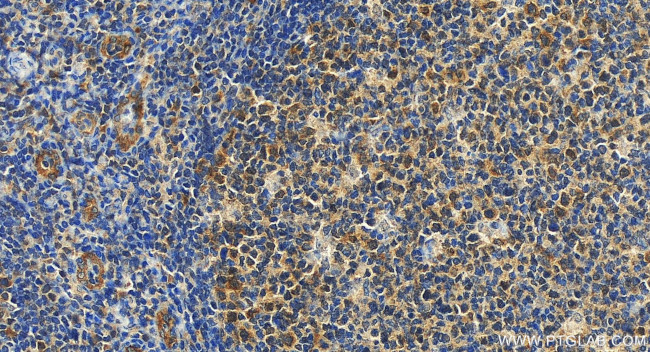 CD320 Antibody in Immunohistochemistry (Paraffin) (IHC (P))