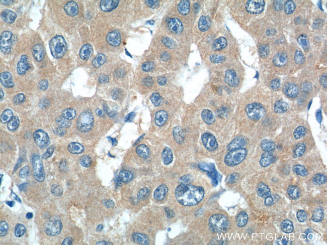 IL-27 Antibody in Immunohistochemistry (Paraffin) (IHC (P))