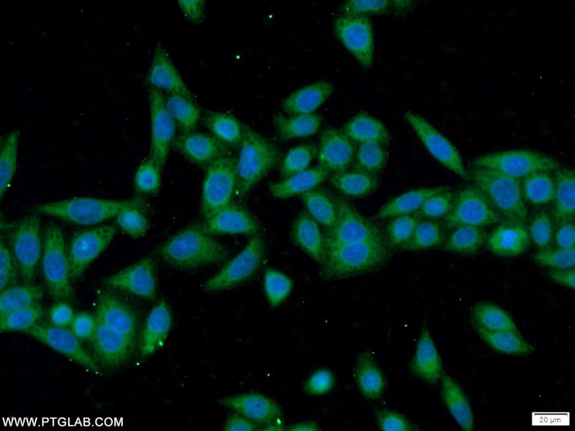 ANKRD55 Antibody in Immunocytochemistry (ICC/IF)