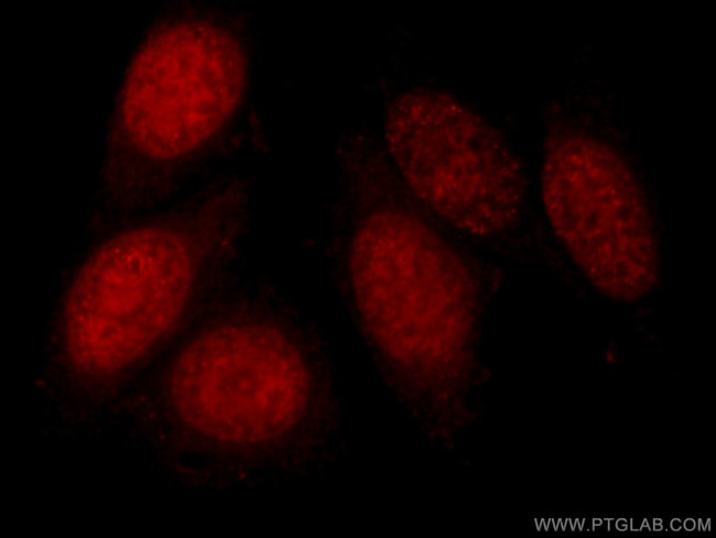 DNMT1 Antibody in Immunocytochemistry (ICC/IF)