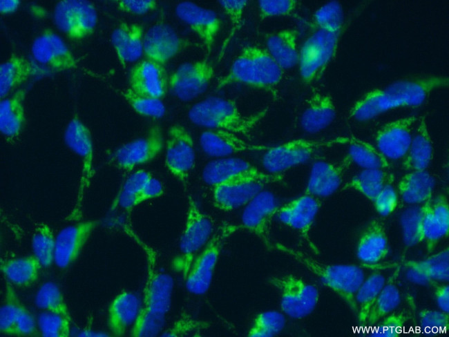 C1orf31 Antibody in Immunocytochemistry (ICC/IF)