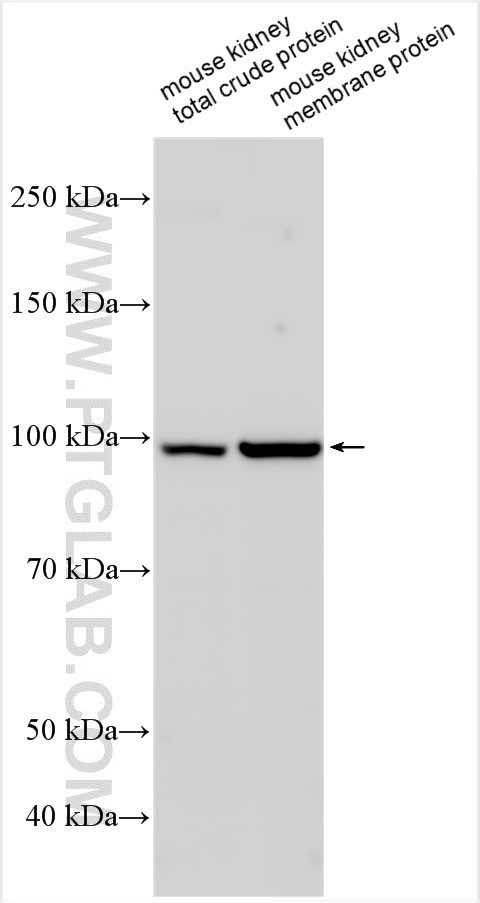 TMEM63B Antibody in Western Blot (WB)