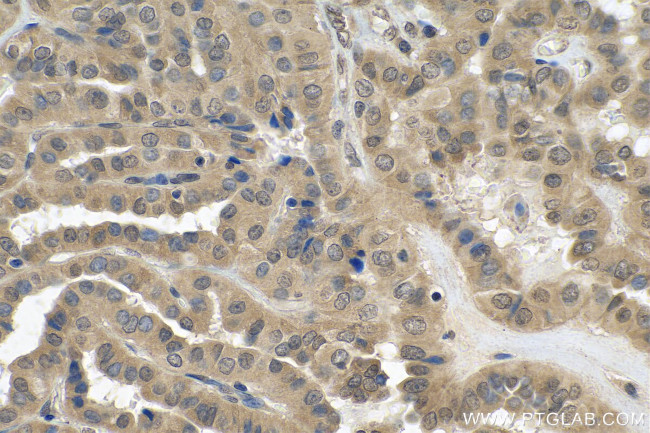 FLYWCH2 Antibody in Immunohistochemistry (Paraffin) (IHC (P))