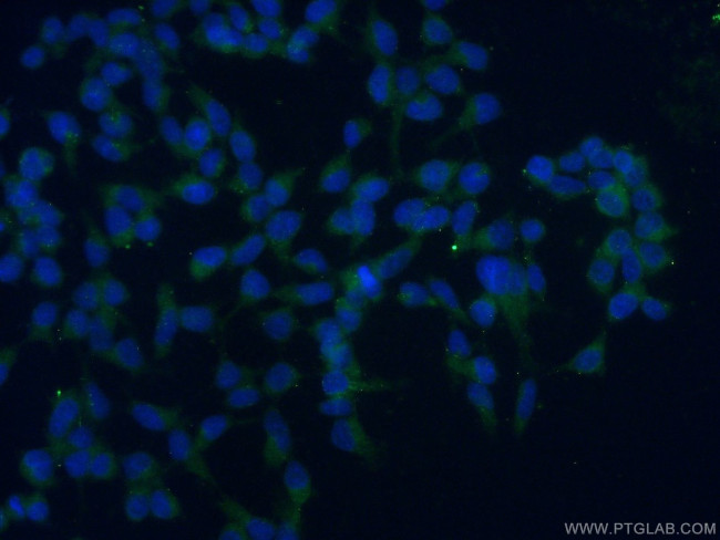 TAF15 Antibody in Immunocytochemistry (ICC/IF)