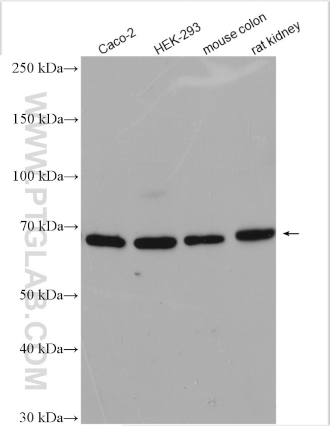 Frizzled 2 Antibody in Western Blot (WB)