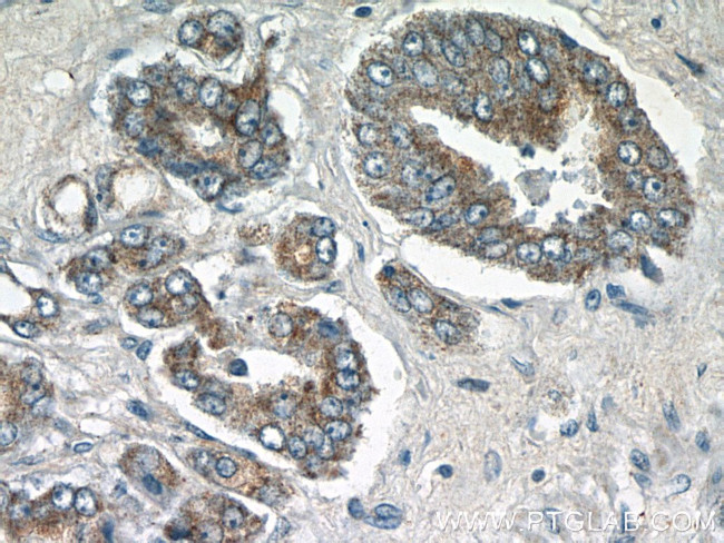 STAC2 Antibody in Immunohistochemistry (Paraffin) (IHC (P))
