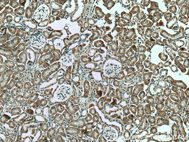 PTH1R Antibody in Immunohistochemistry (Paraffin) (IHC (P))