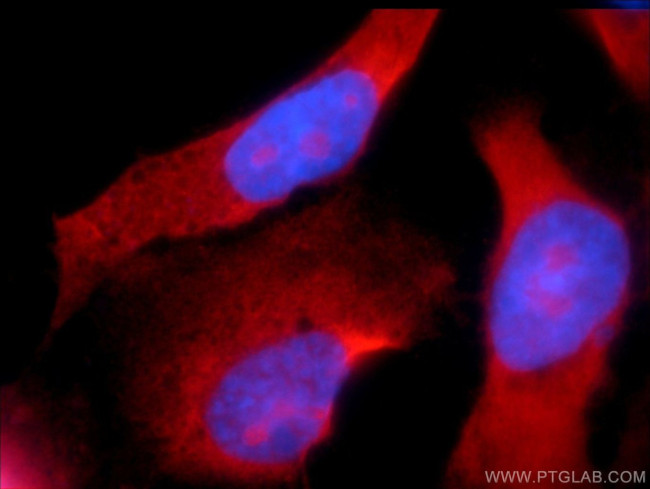 CCDC104 Antibody in Immunocytochemistry (ICC/IF)