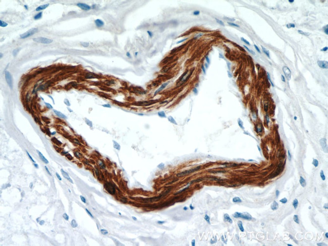 FBXO28 Antibody in Immunohistochemistry (Paraffin) (IHC (P))