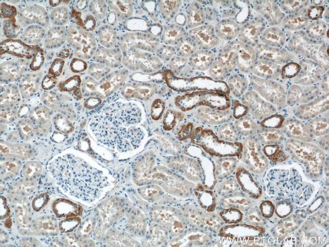 FOXB1 Antibody in Immunohistochemistry (Paraffin) (IHC (P))