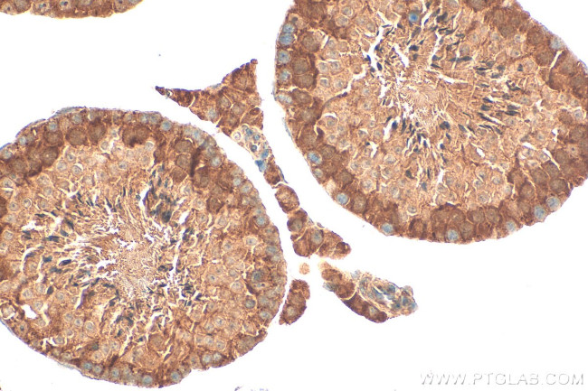 MIF4GD Antibody in Immunohistochemistry (Paraffin) (IHC (P))