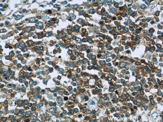 RFTN1 Antibody in Immunohistochemistry (Paraffin) (IHC (P))