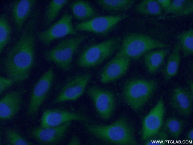 F2 Antibody in Immunocytochemistry (ICC/IF)