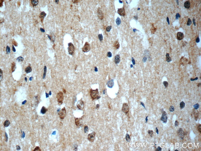 SNRNP48 Antibody in Immunohistochemistry (Paraffin) (IHC (P))