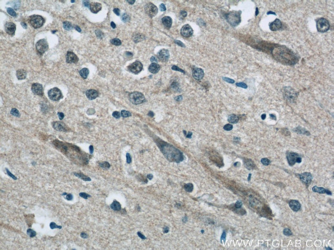 MFSD8 Antibody in Immunohistochemistry (Paraffin) (IHC (P))