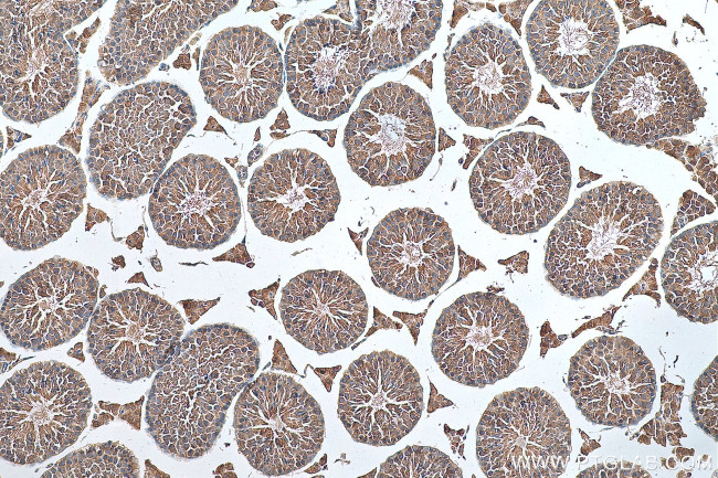 RNF17 Antibody in Immunohistochemistry (Paraffin) (IHC (P))