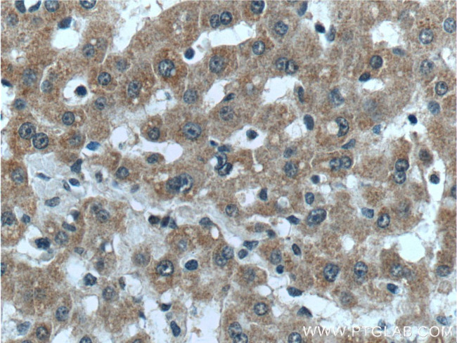 LYSMD3 Antibody in Immunohistochemistry (Paraffin) (IHC (P))