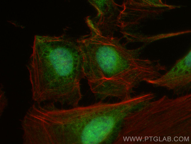 BCORL1 Antibody in Immunocytochemistry (ICC/IF)