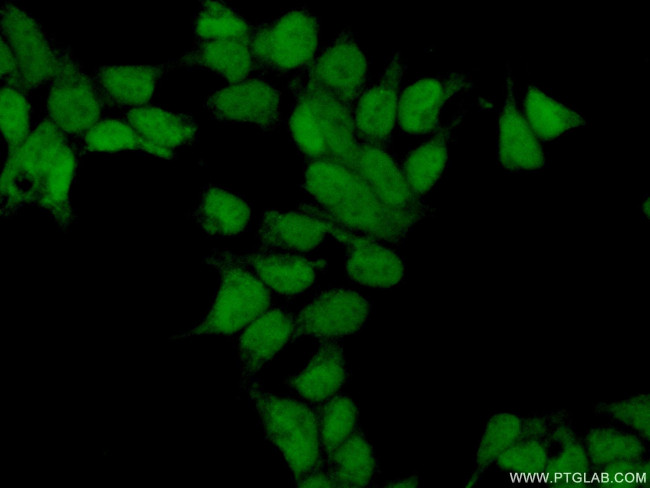 C5orf24 Antibody in Immunocytochemistry (ICC/IF)