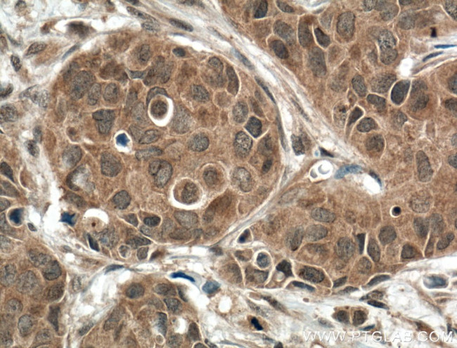 DGKB Antibody in Immunohistochemistry (Paraffin) (IHC (P))