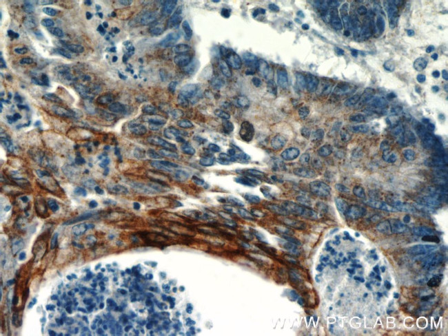 TMEM9B Antibody in Immunohistochemistry (Paraffin) (IHC (P))