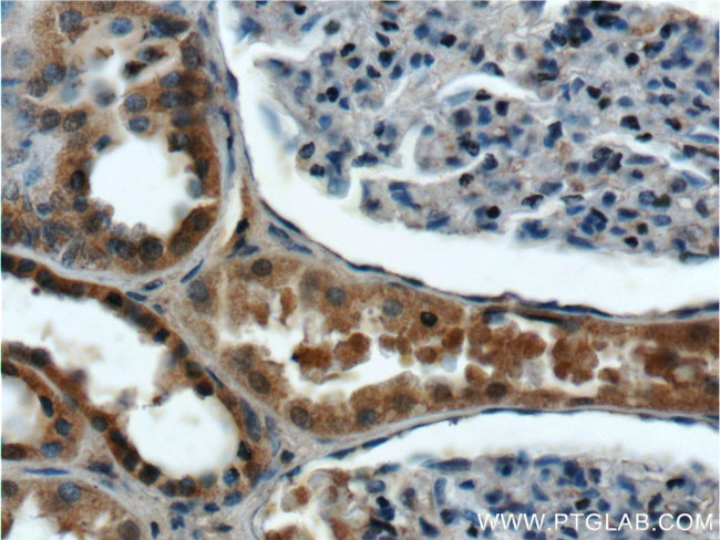 ANKRD6 Antibody in Immunohistochemistry (Paraffin) (IHC (P))