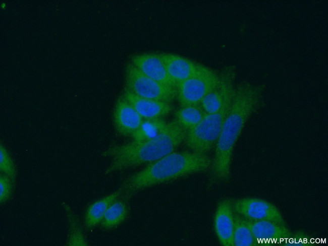 ANKRD16 Antibody in Immunocytochemistry (ICC/IF)