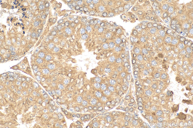 BBOF1 Antibody in Immunohistochemistry (Paraffin) (IHC (P))