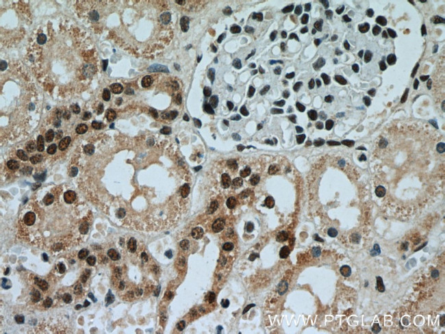 AQR Antibody in Immunohistochemistry (Paraffin) (IHC (P))