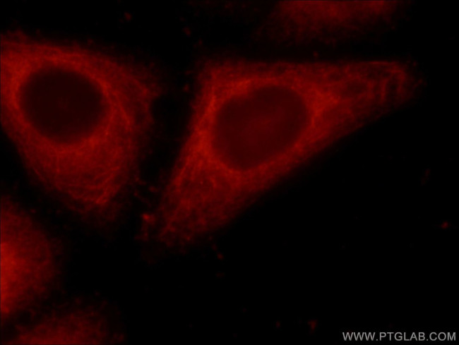 ERP29 Antibody in Immunocytochemistry (ICC/IF)