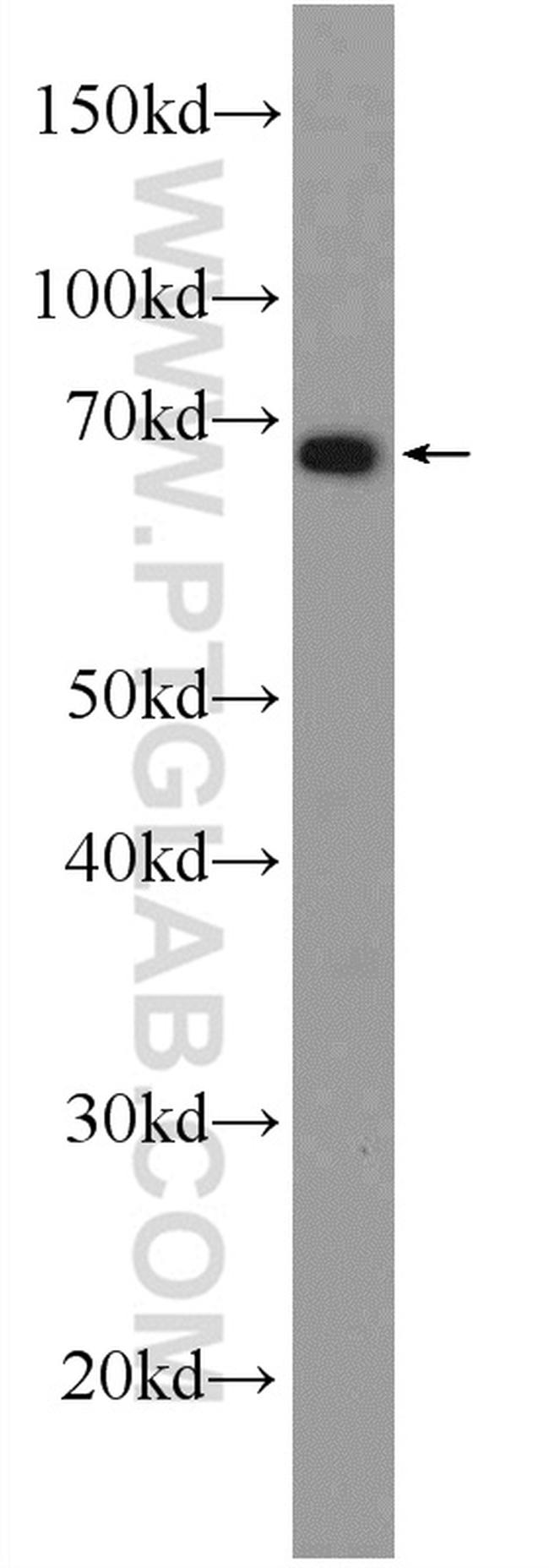DMRTA1 Antibody in Western Blot (WB)