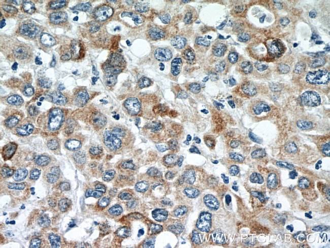 TMEM25 Antibody in Immunohistochemistry (Paraffin) (IHC (P))