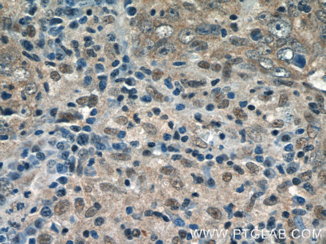 GPATCH2 Antibody in Immunohistochemistry (Paraffin) (IHC (P))