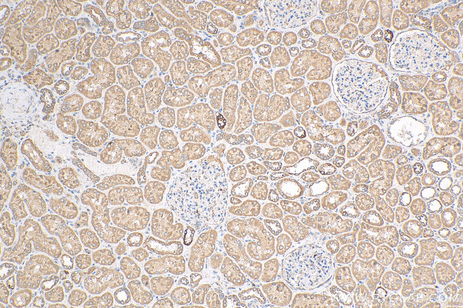RBM46 Antibody in Immunohistochemistry (Paraffin) (IHC (P))